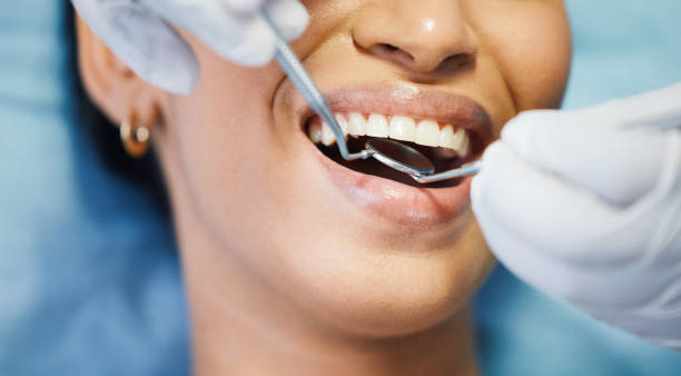 Best Emergency Root Canal Treatment in Cadillac, MI
